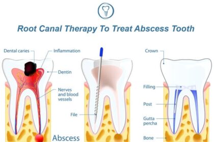 Silent Threat: How Dental Infections Are Destroying Your Body from the Inside Out 🦷💔