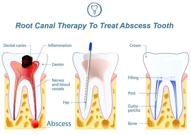 Silent Threat: How Dental Infections Are Destroying Your Body from the Inside Out 🦷💔